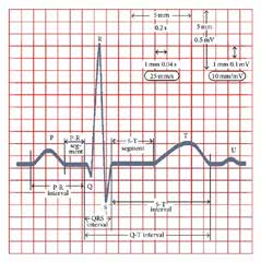 הגלים והמקטעים הבסיסיים בתרשים אק"ג - P, QRS, T, מקטע ST ומרווח QT